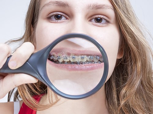 caring for braces at school